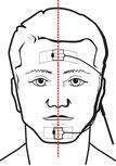 JAWAC`s Chin sensor with its forehead reference electrode