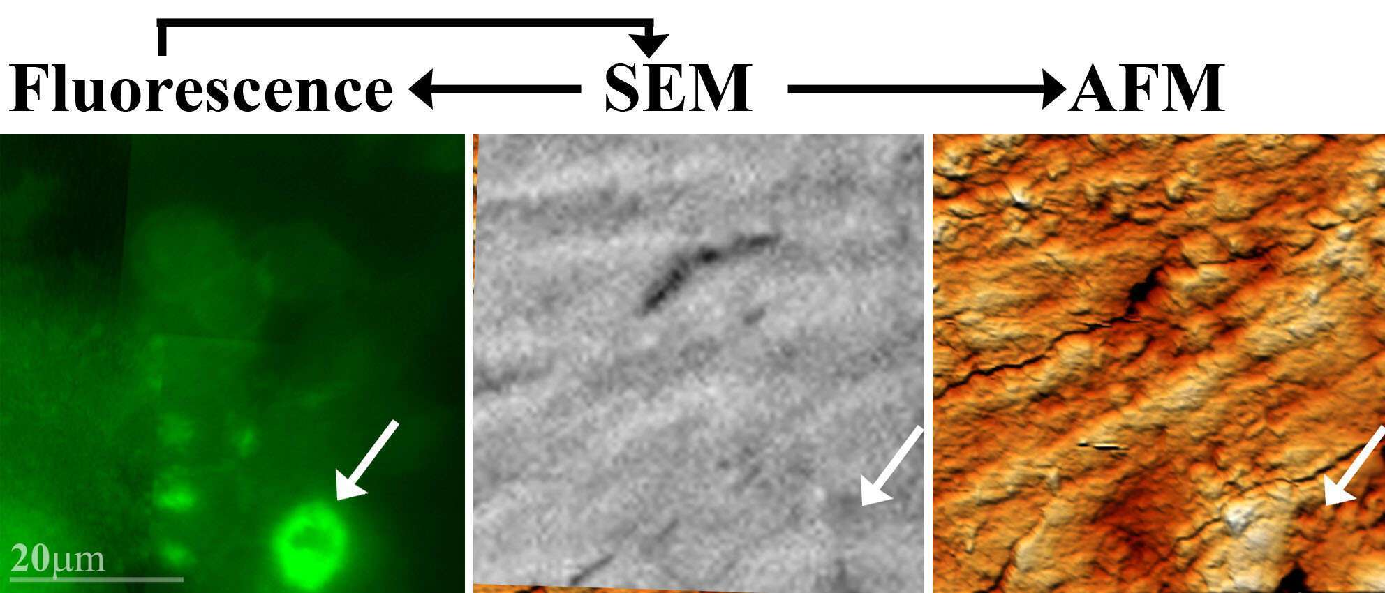 Correlation between sealing zone rings in osteoclasts and bone surface as imaged by the SEM and AFM