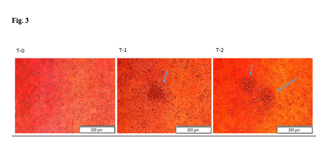 A representative example showing inverted microscope analysis for cEPCs capacity to form colonies (arrows), before and after 1 month and 3 months of treatment with empagliflozin 