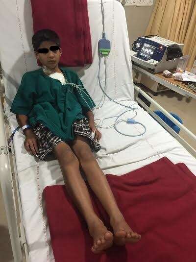 The 10 year old child with TDP