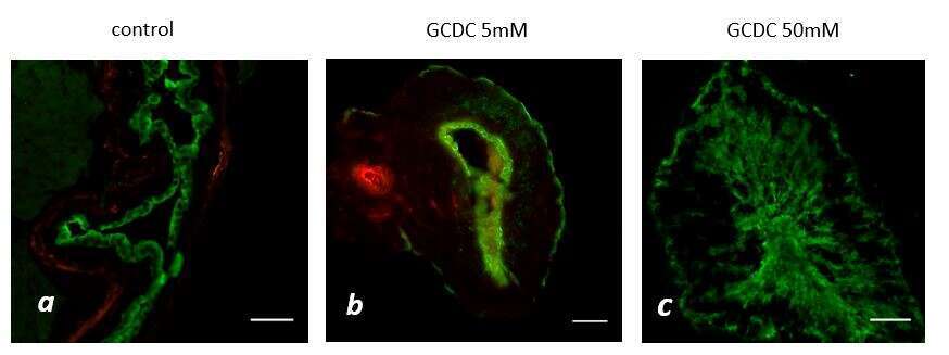 Figure 3: Adult mice extrahepatic bile ducts were dissected and incubated for 24 hours with and without GCDCA at 5 and 50mM. (a) control (b) GCDCA at 5 mM (c) GCDCA at 50 mM. Scale bar, 50 μm.