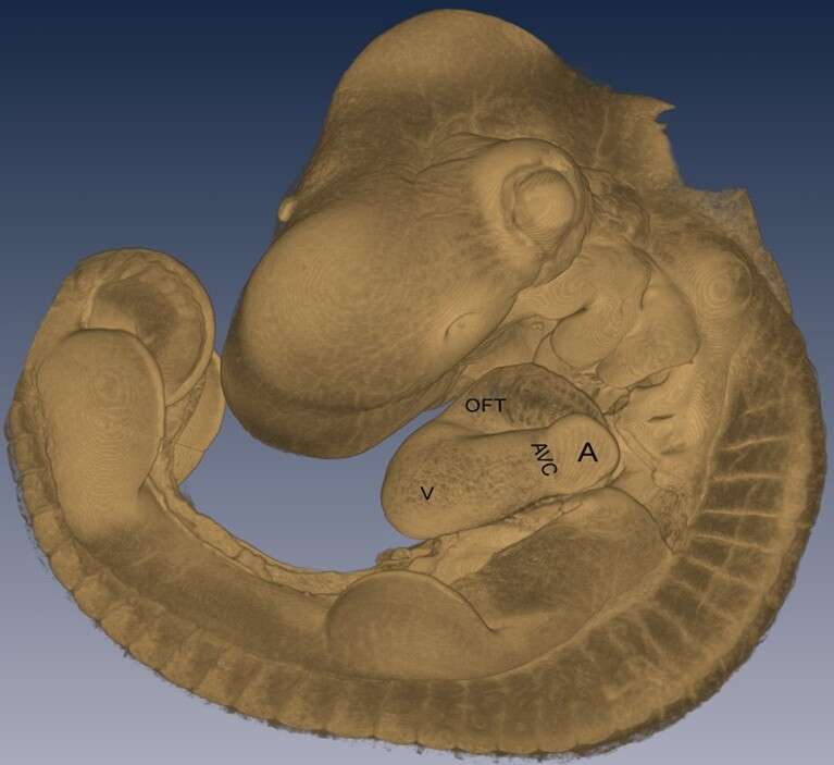 3D HREM model of chick embryo