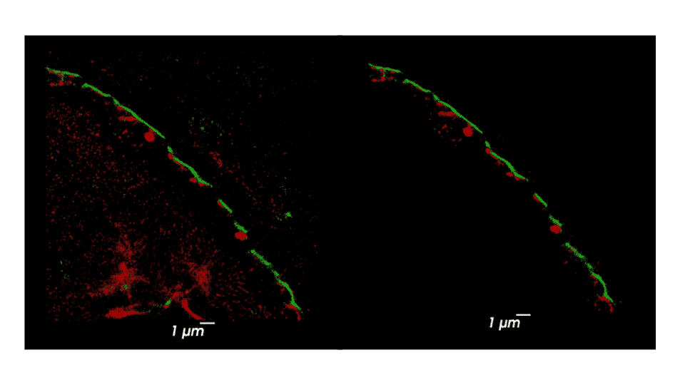 Phosphorylated alpha-synuclein total image, and selected region of interest for analysis